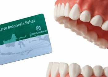 Cara Pasang Gigi Palsu Menggunakan BPJS Kesehatan 2025: Syarat dan Ketentuannya